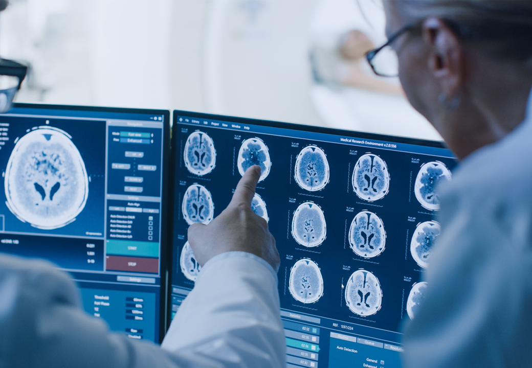 5 Best Foods For Dementia Prevention (& Why They Work)